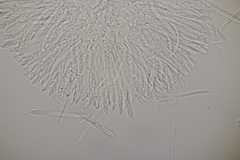 Pyrenopeziza petiolaris