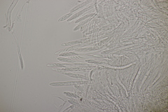 Pyrenopeziza petiolaris