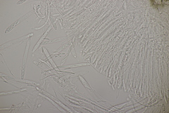 Pyrenopeziza petiolaris