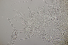 Pyrenopeziza petiolaris