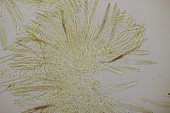 Pyrenopeziza petiolaris