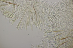 Pyrenopeziza petiolaris