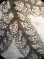 Trichocolea hatcheri