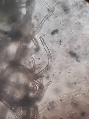 Trichocolea mollissima