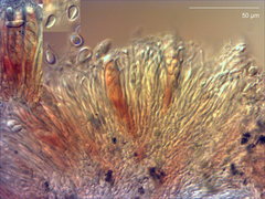 Pseudopeziza trifolii