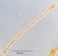 Hyperomyzus lactucae