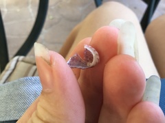 Stomatella impertusa