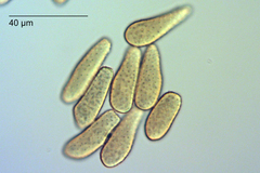 Melampsoridium betulinum