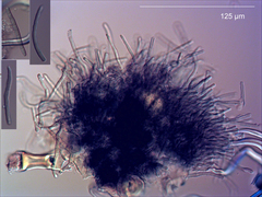 Pseudocercospora oleariae