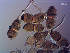 Puccinia akiraho