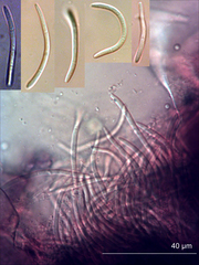 Pseudocercospora dodonaeae