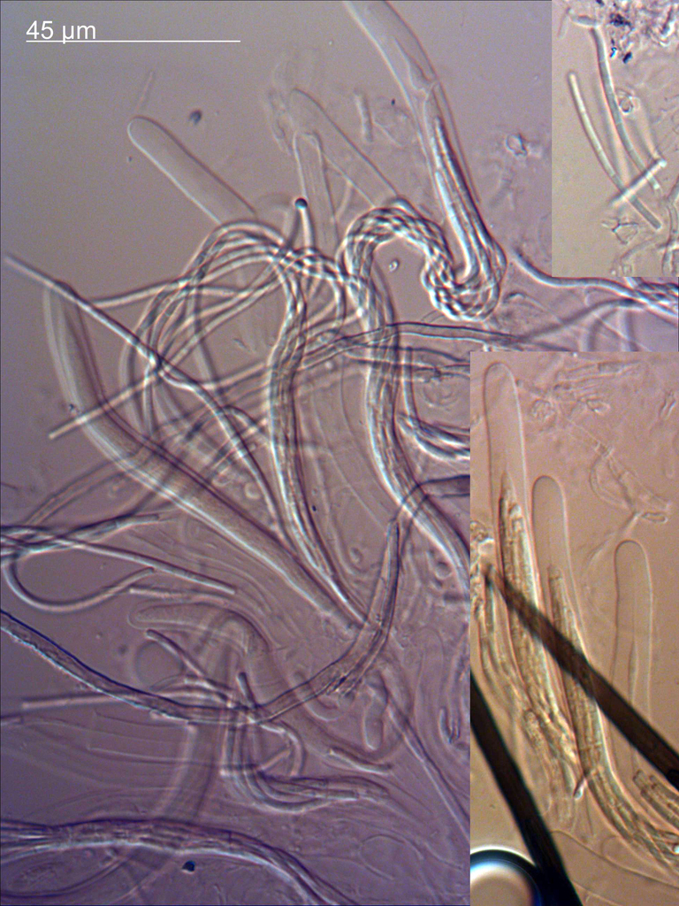 Acanthophiobolus