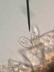 Vorticella