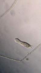 Gastrotricha