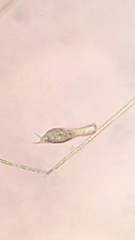Gastrotricha