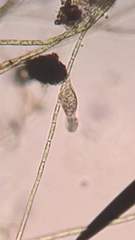 Gastrotricha
