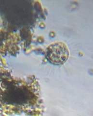Actinosphaerium