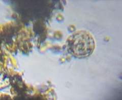 Actinosphaerium