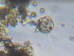 Actinosphaerium