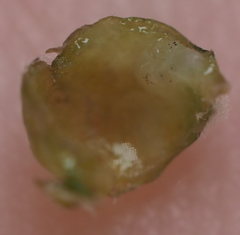 Andricus quercusutriculus