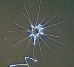 Asterionellopsis glacialis