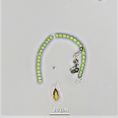 Cyanothrix cavanillesii