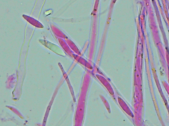 Mitrula lunulatospora