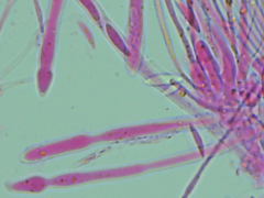 Mitrula lunulatospora