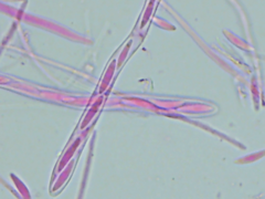 Mitrula lunulatospora