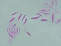 Mitrula lunulatospora