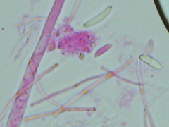 Mitrula lunulatospora