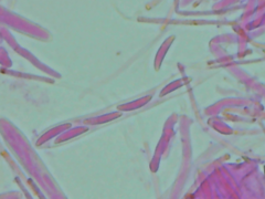 Mitrula lunulatospora