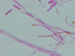 Mitrula lunulatospora