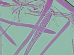 Mitrula lunulatospora