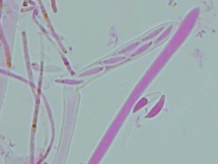 Mitrula lunulatospora