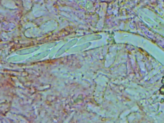 Mitrula lunulatospora