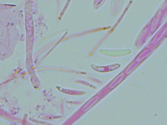 Mitrula lunulatospora