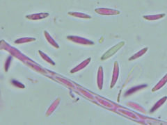 Mitrula lunulatospora