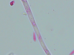 Mitrula lunulatospora