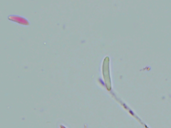 Mitrula lunulatospora