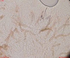 Fuscolachnum misellum