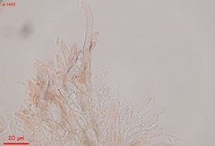 Fuscolachnum misellum