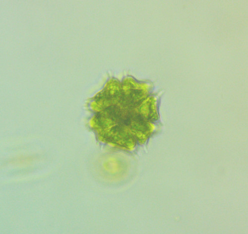 Sorastrum spinulosum