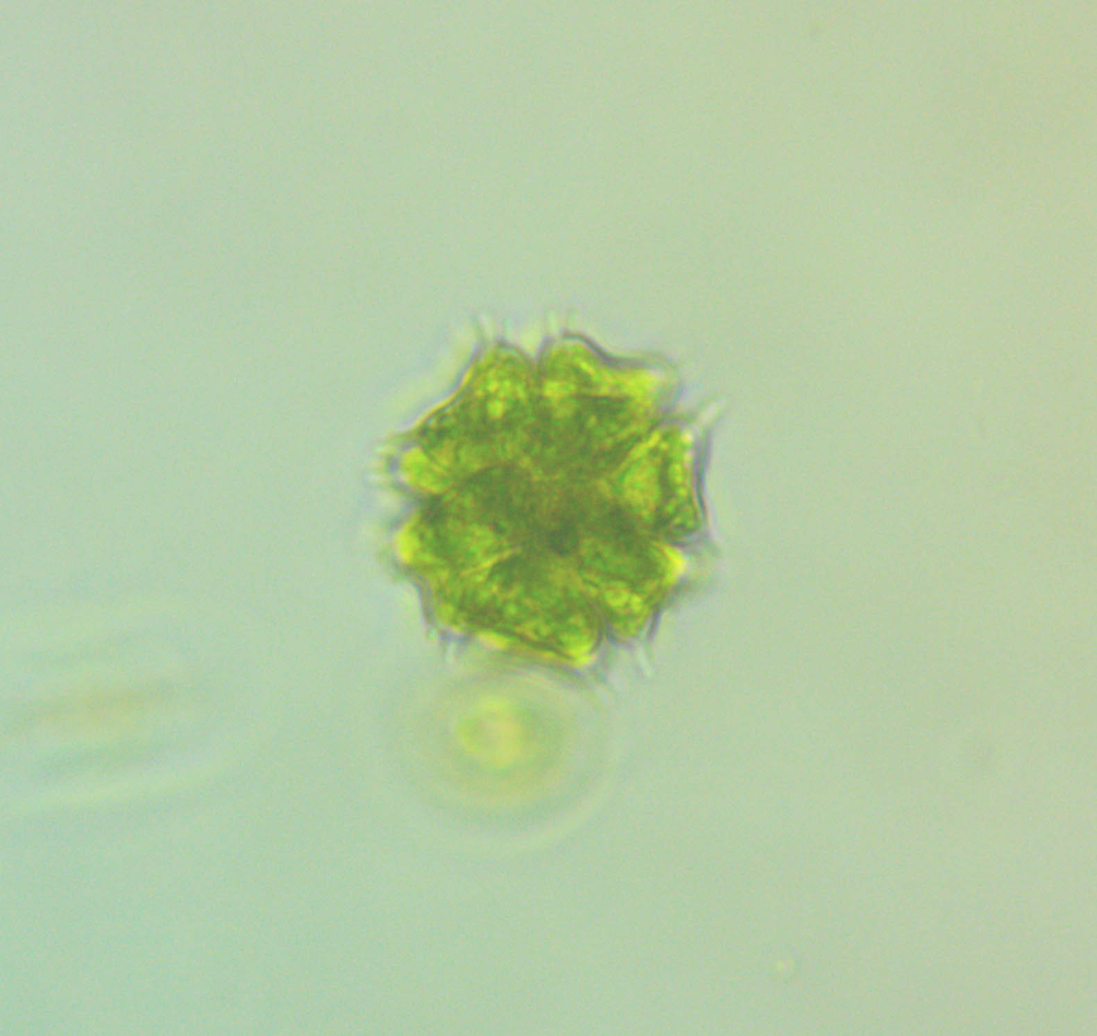 Sorastrum spinulosum