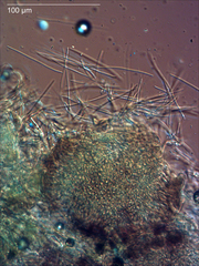 Septoria stellariae