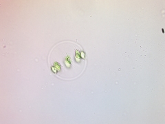 Stephanosphaera pluvialis