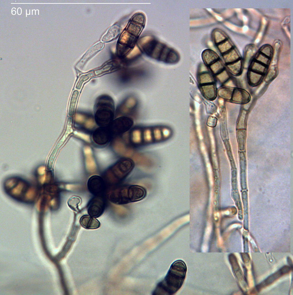 Paradendryphiella