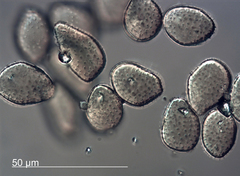 Pucciniastrum epilobii