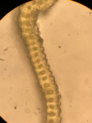 Racomitrium brevipes