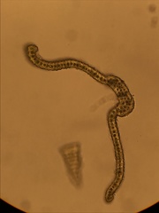 Racomitrium brevipes